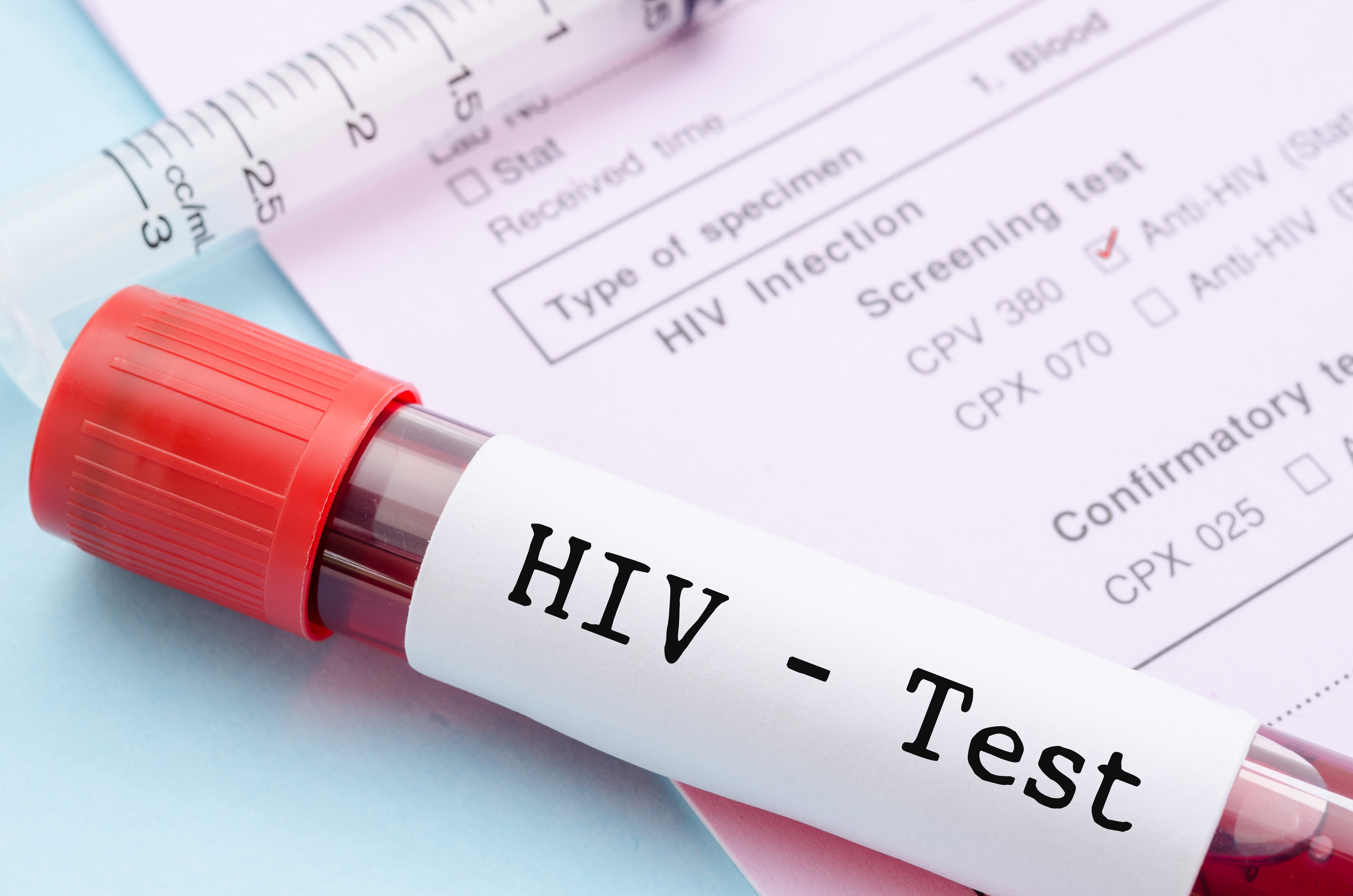 HIV test kiti eczanede satılır mı?