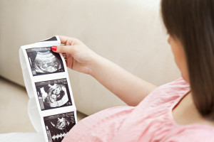 Pregnant Woman Looking At Ultrasound Scan Of Baby
